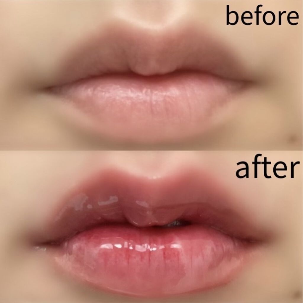 Qoo10/Qoo10/シートマスク・パックを使ったクチコミ（2枚目）