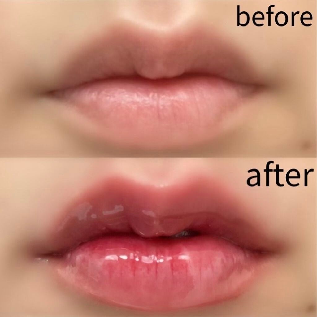 Qoo10/Qoo10/シートマスク・パックを使ったクチコミ(2枚目)