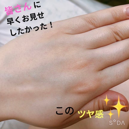 光脱毛器 VIO/Sarlisi/家庭用脱毛器を使ったクチコミ(4枚目)