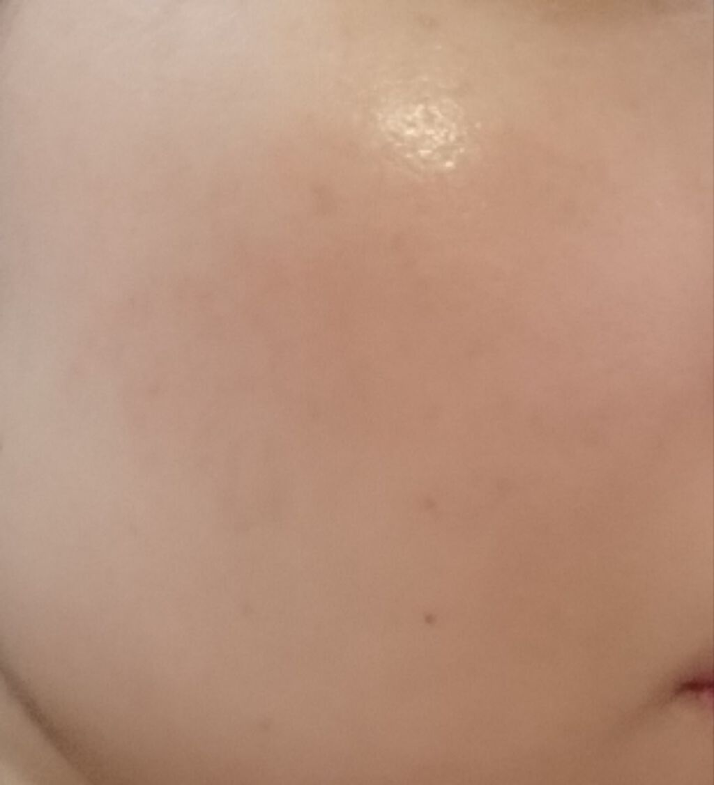 シミ対策美容液/アクアレーベル/美容液を使ったクチコミ(2枚目)