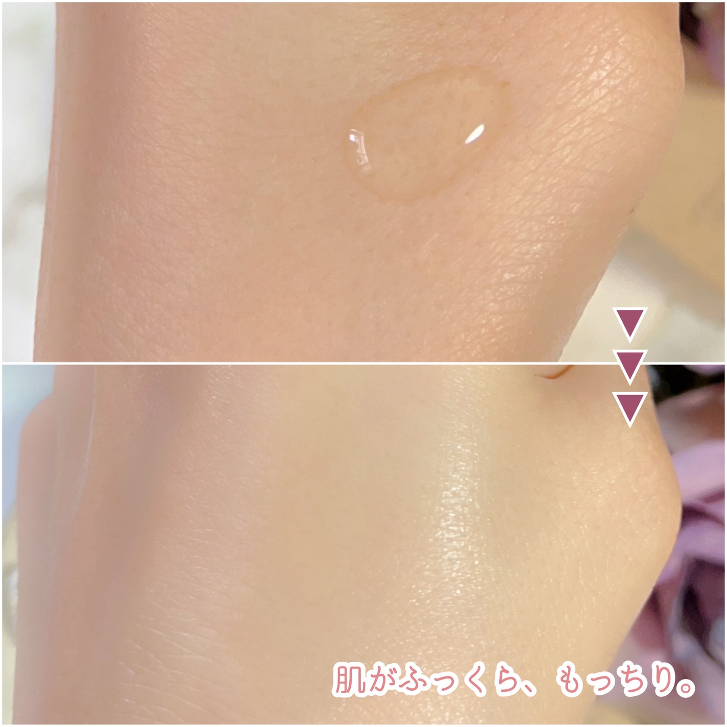 オイルインエッセンス/MUQURU/ブースター・導入液を使ったクチコミ(5枚目)