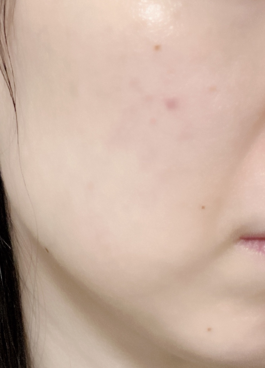 ジェノプティクス オーラ エッセンス/SK-II/美容液を使ったクチコミ（2枚目）