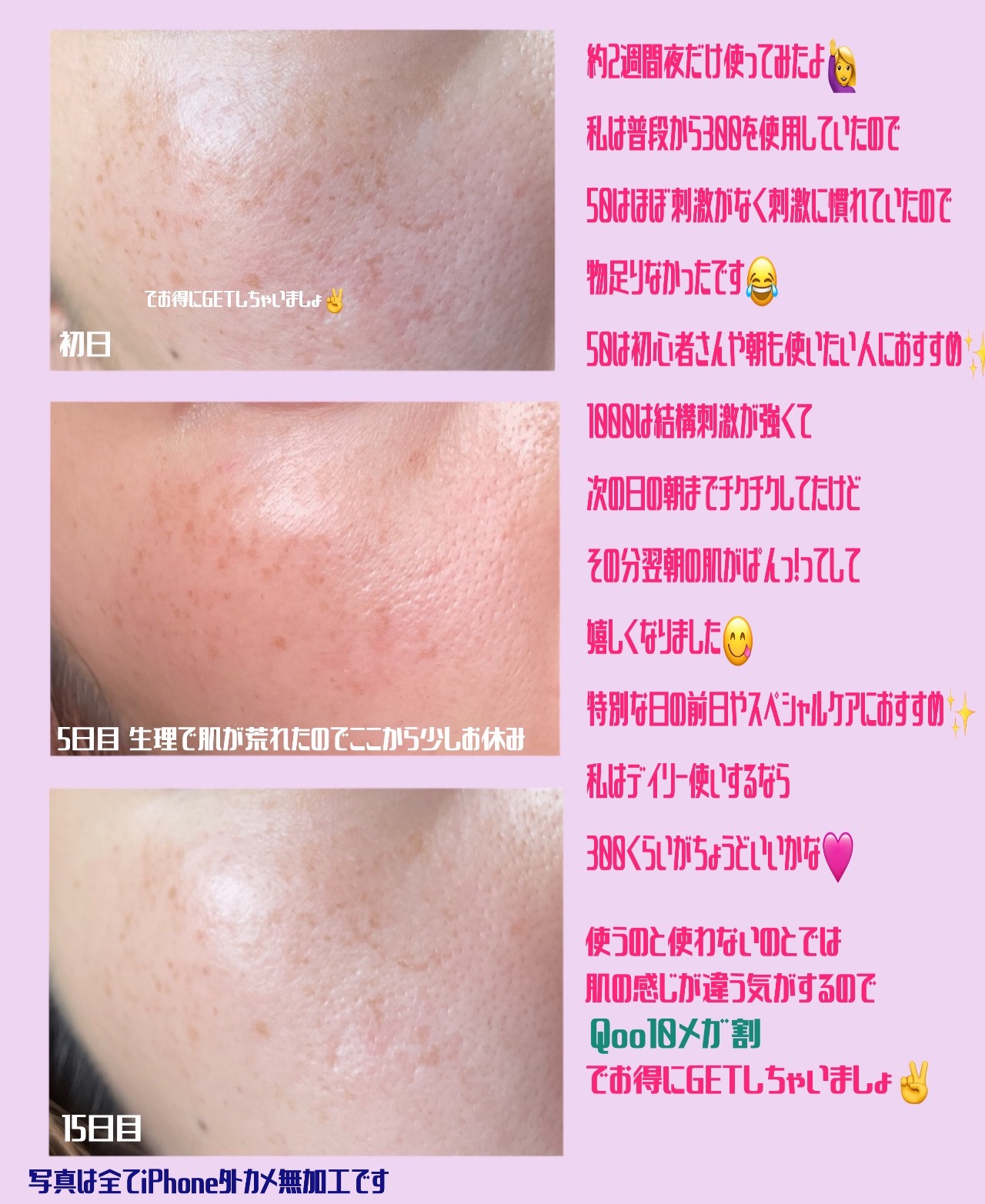 マイルドリードルショット50/VT/美容液を使ったクチコミ（3枚目）