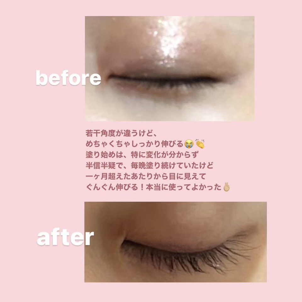 ラッシュアディクト アイラッシュコンディショニングセラム/soaddicted/まつげ美容液を使ったクチコミ（3枚目）