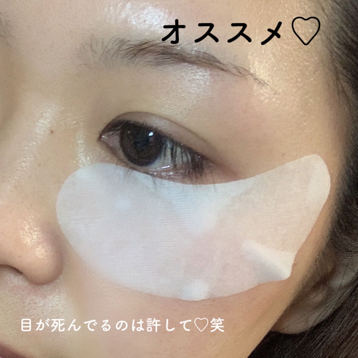 リアルビタ アイゾーンパッチ/Prreti/シートマスク・パックを使ったクチコミ(8枚目)