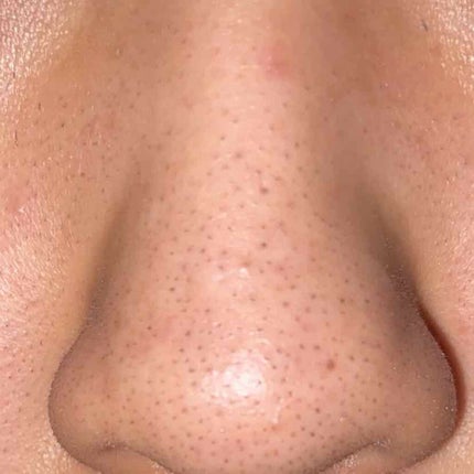 ㎠on LIPS ãð»åæçš¿ã»æ¯ç©Žã®åå ç§ã®å Žåãåç²§ããã¯ãããŠããæ¯ç©Žãã§ããŠ..ãïŒ4æç®ïŒ