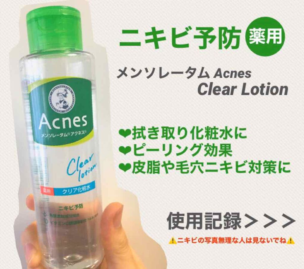 薬用クリア化粧水/メンソレータム アクネス/化粧水を使ったクチコミ（1枚目）