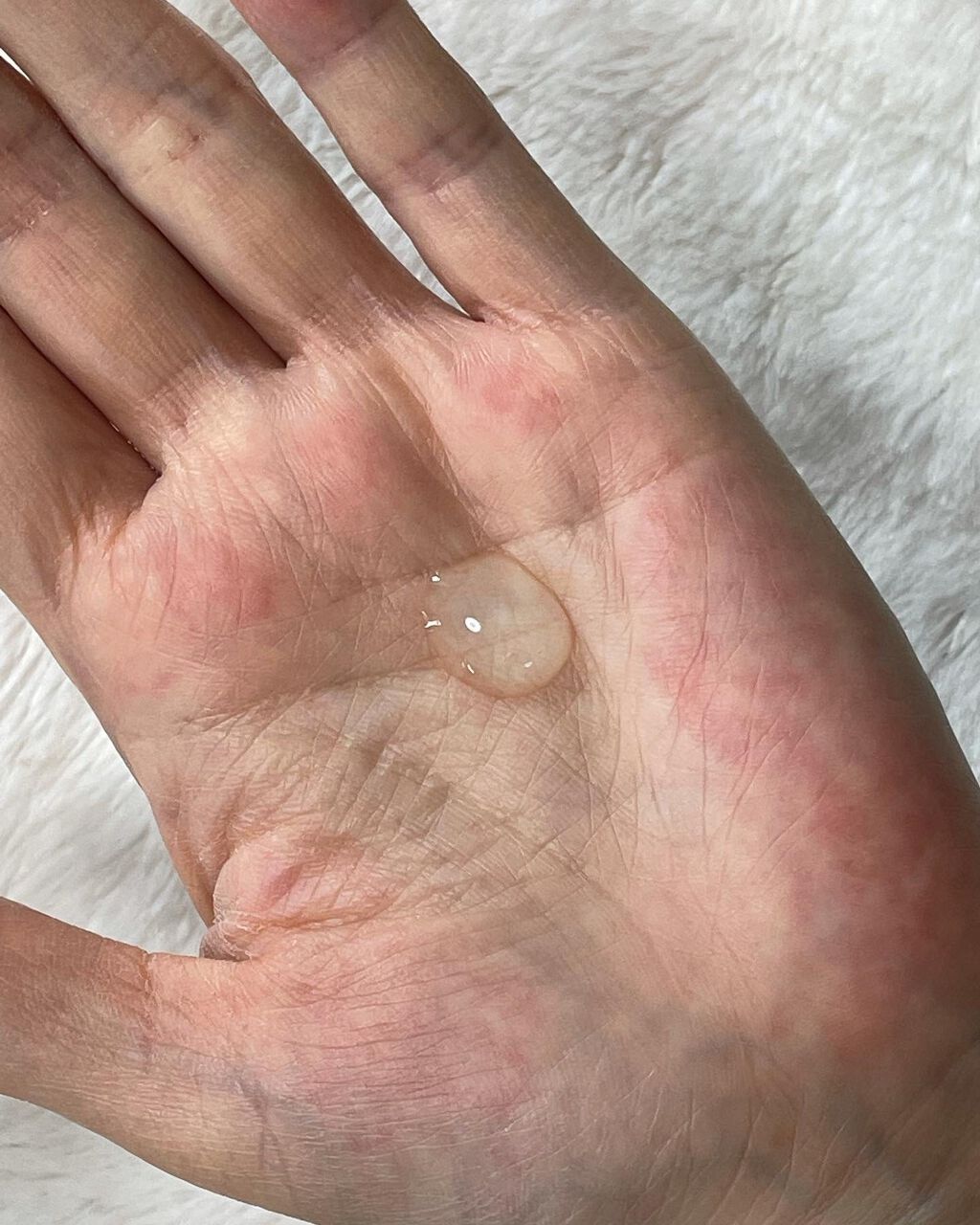 SAIKAU lotion(催花雨ローション)/こころ配り便/オールインワン化粧品を使ったクチコミ(2枚目)