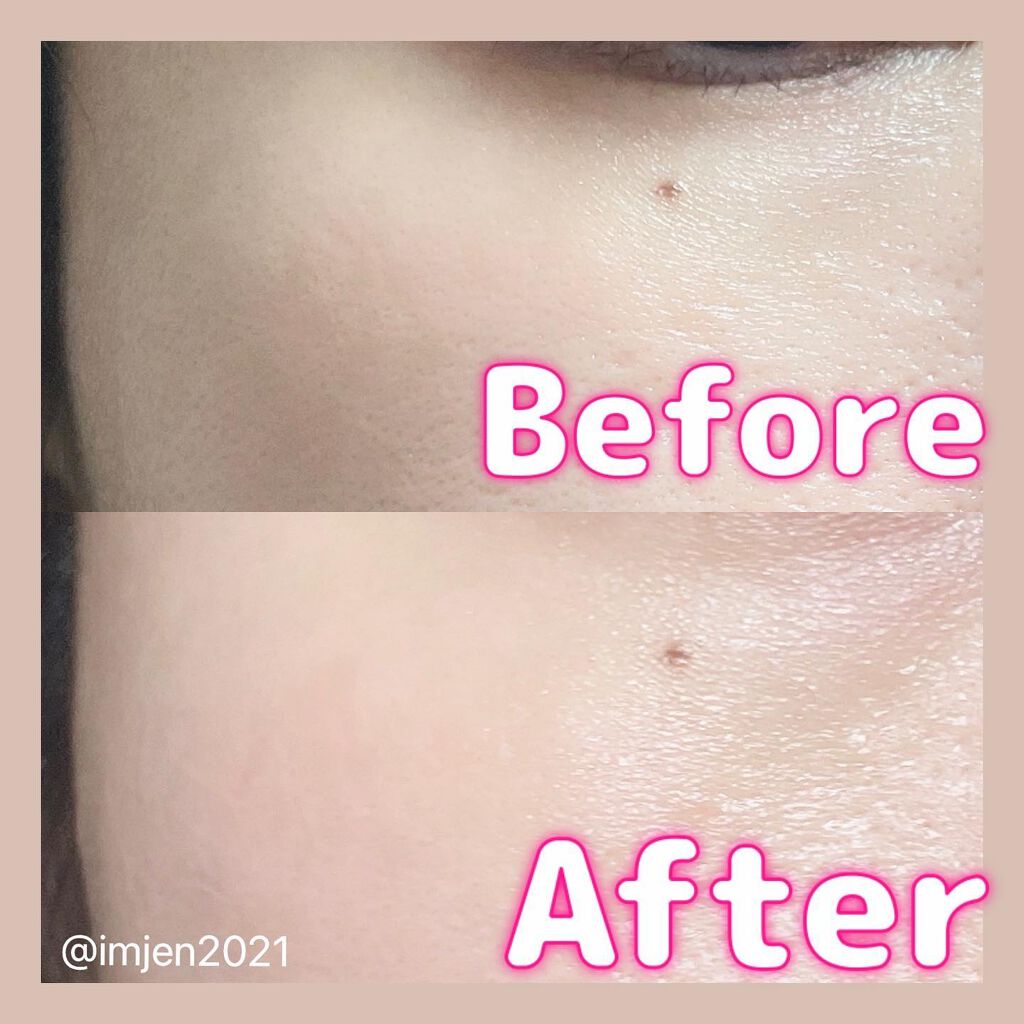 カワラヨモギ70カーミングクリーム/RE:GET/フェイスクリームを使ったクチコミ(4枚目)