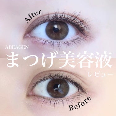 アイラッシュセラム まつげ美容液/ABEAGEN/美容液を使ったクチコミ（1枚目）