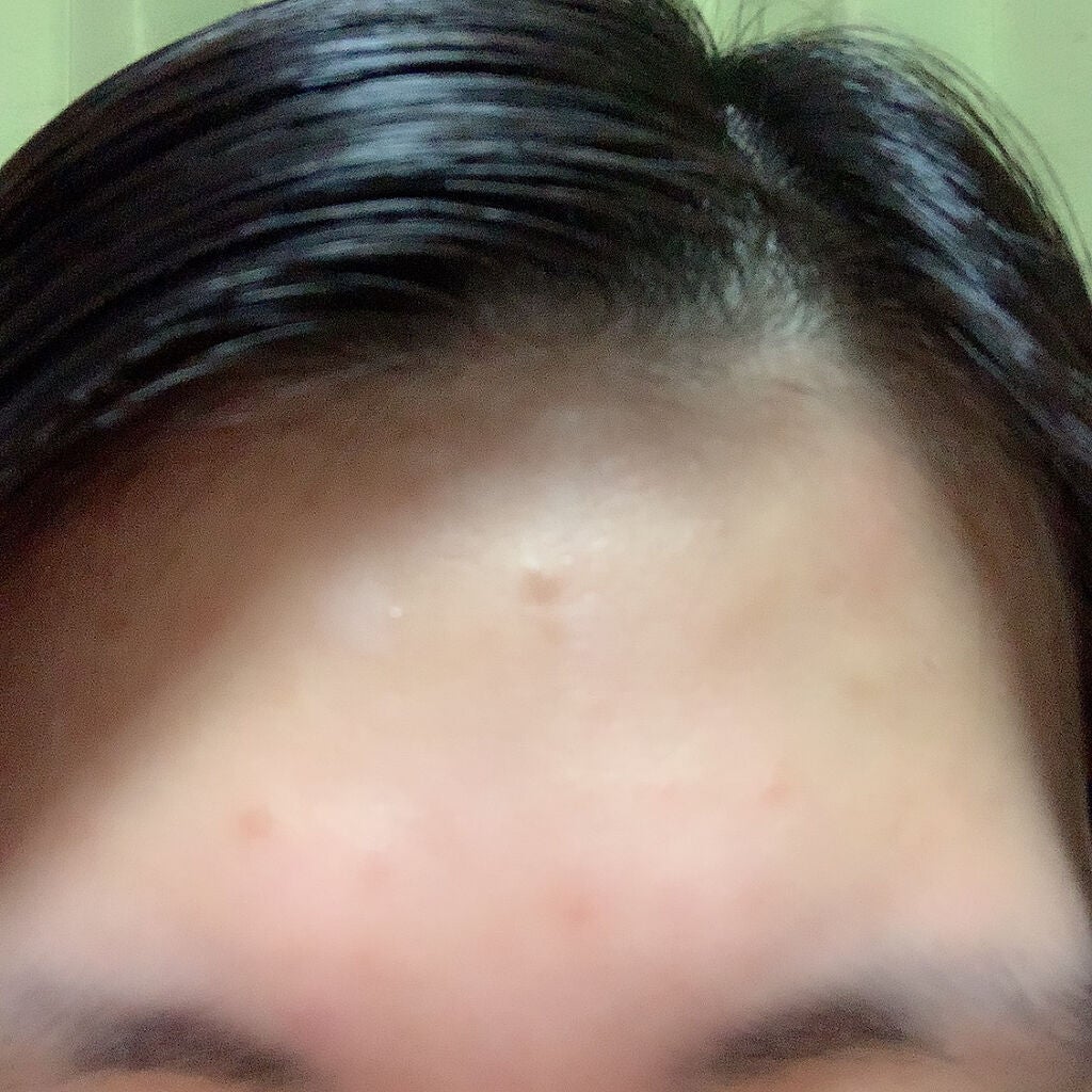 アルビオン 薬用スキンコンディショナー エッセンシャル/ALBION/化粧水を使ったクチコミ(5枚目)