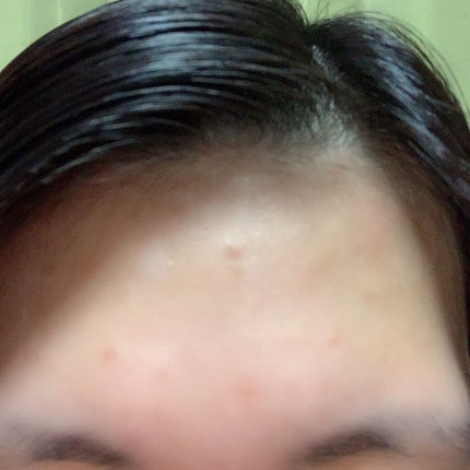 アルビオン 薬用スキンコンディショナー エッセンシャル/ALBION/化粧水を使ったクチコミ(5枚目)