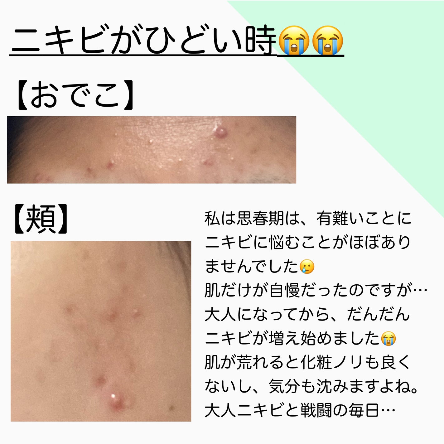 ザ・タイムR アクア/IPSA/化粧水を使ったクチコミ(2枚目)