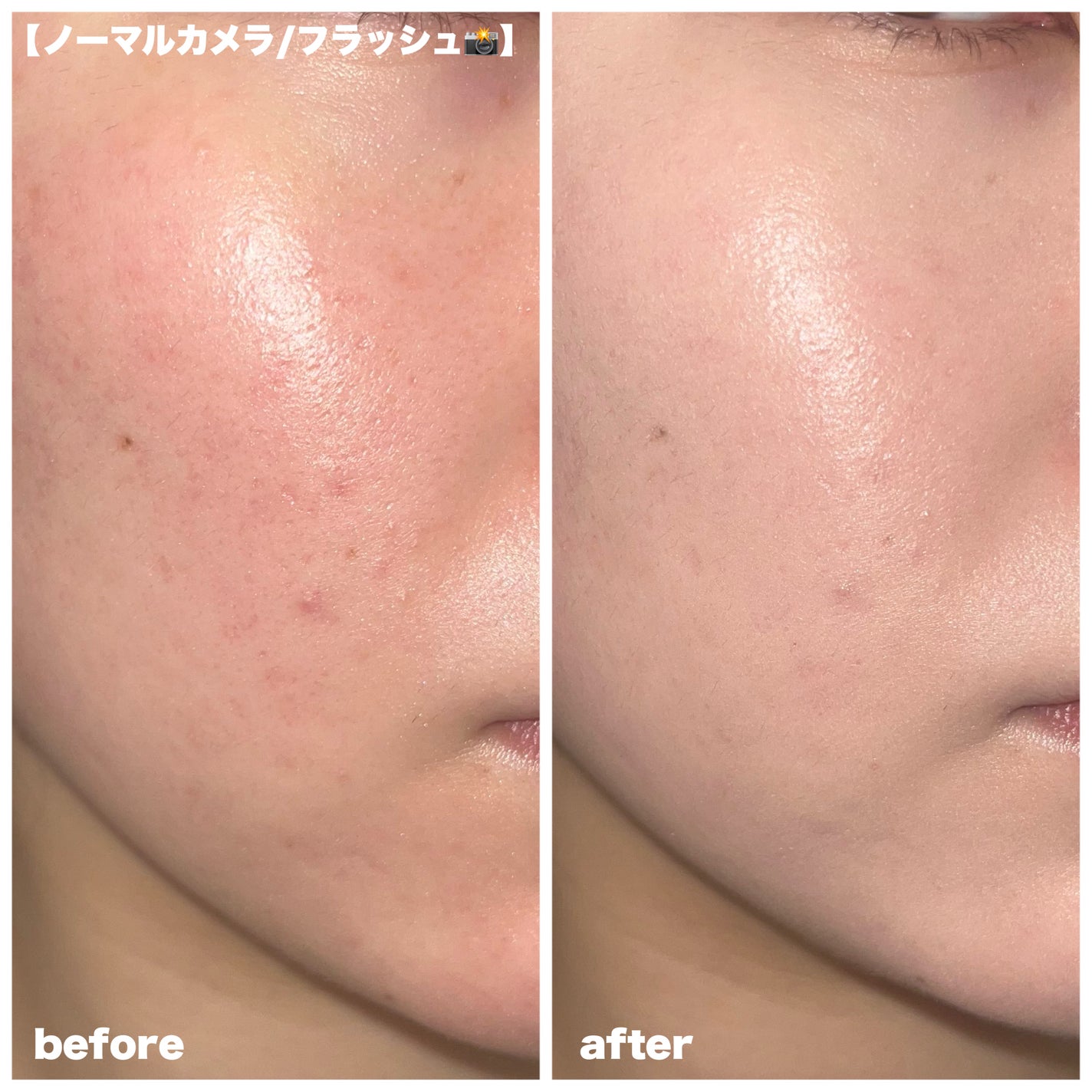 カバーリシャス アルティメット ホワイトクッション モイスチャー/BANILA CO/クッションファンデーションを使ったクチコミ(4枚目)