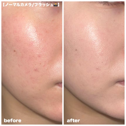 カバーリシャス アルティメット ホワイトクッション モイスチャー/BANILA CO/クッションファンデーションを使ったクチコミ(4枚目)