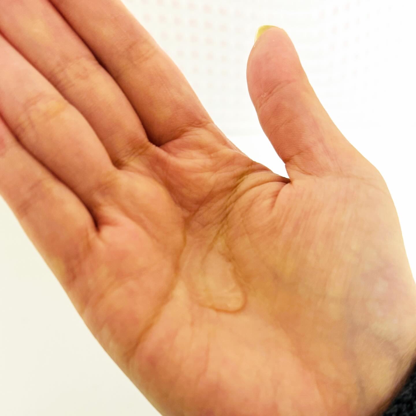 ホームピールコンセントレート/HERBAL PEEL/化粧水を使ったクチコミ（3枚目）