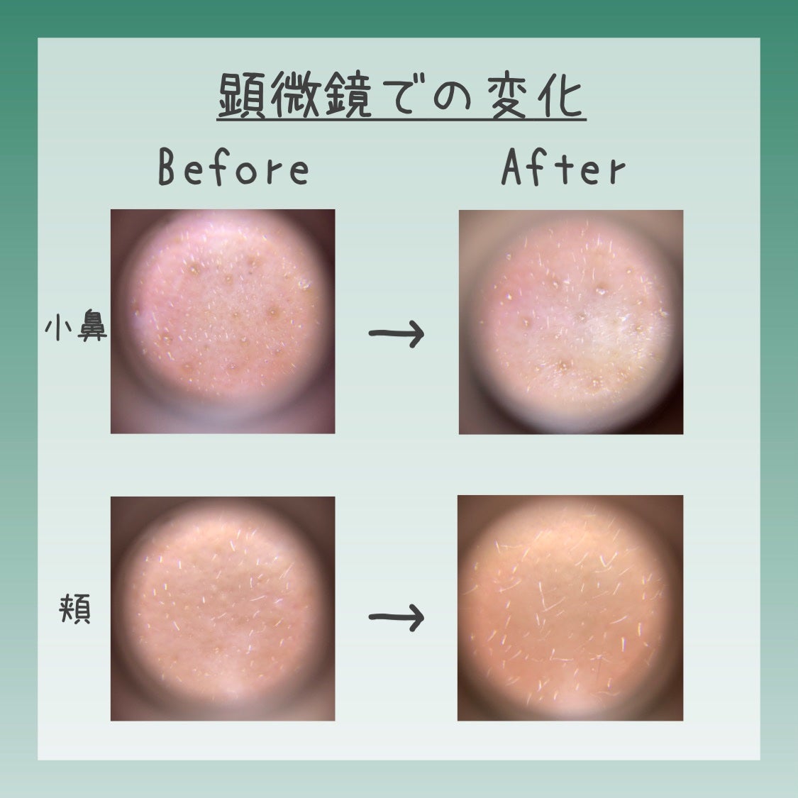 CICA クリーム/VT/フェイスクリームを使ったクチコミ(2枚目)