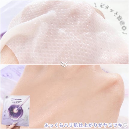 プロバイオダーム™ コラーゲンリモデリングゲルマスク/BIOHEAL BOH/シートマスク・パックを使ったクチコミ(5枚目)
