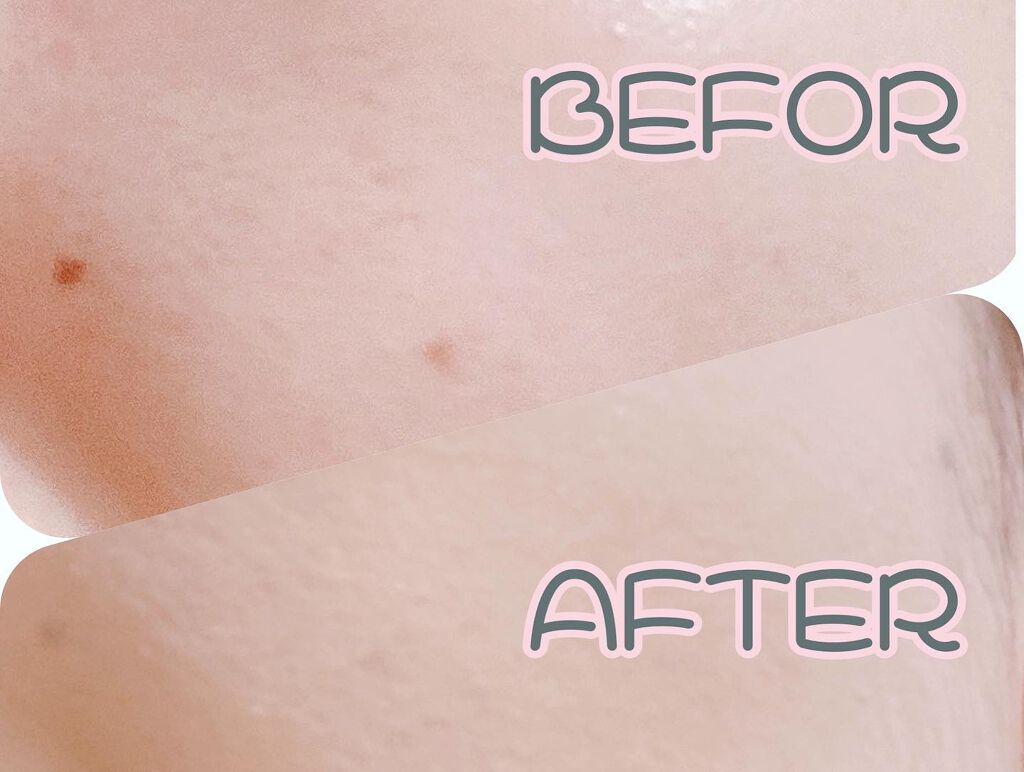 ピンクティーツリーカバークッション/APLIN/クッションファンデーションを使ったクチコミ(7枚目)