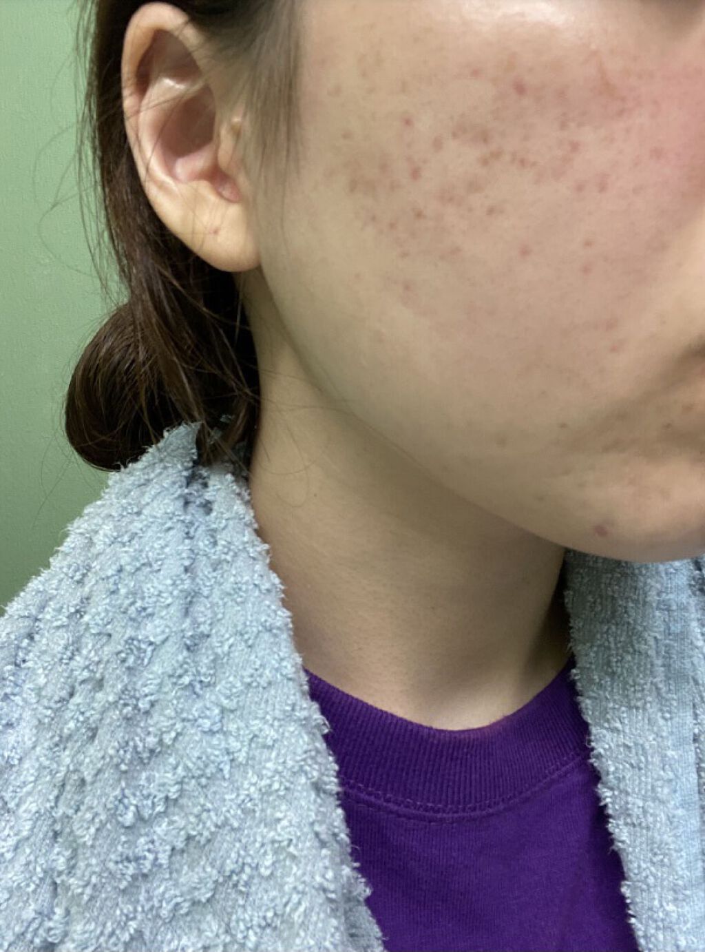 ブライト＆バウンシングローション（ノーマルタイプ）/ジュレリッチ/化粧水を使ったクチコミ（1枚目）