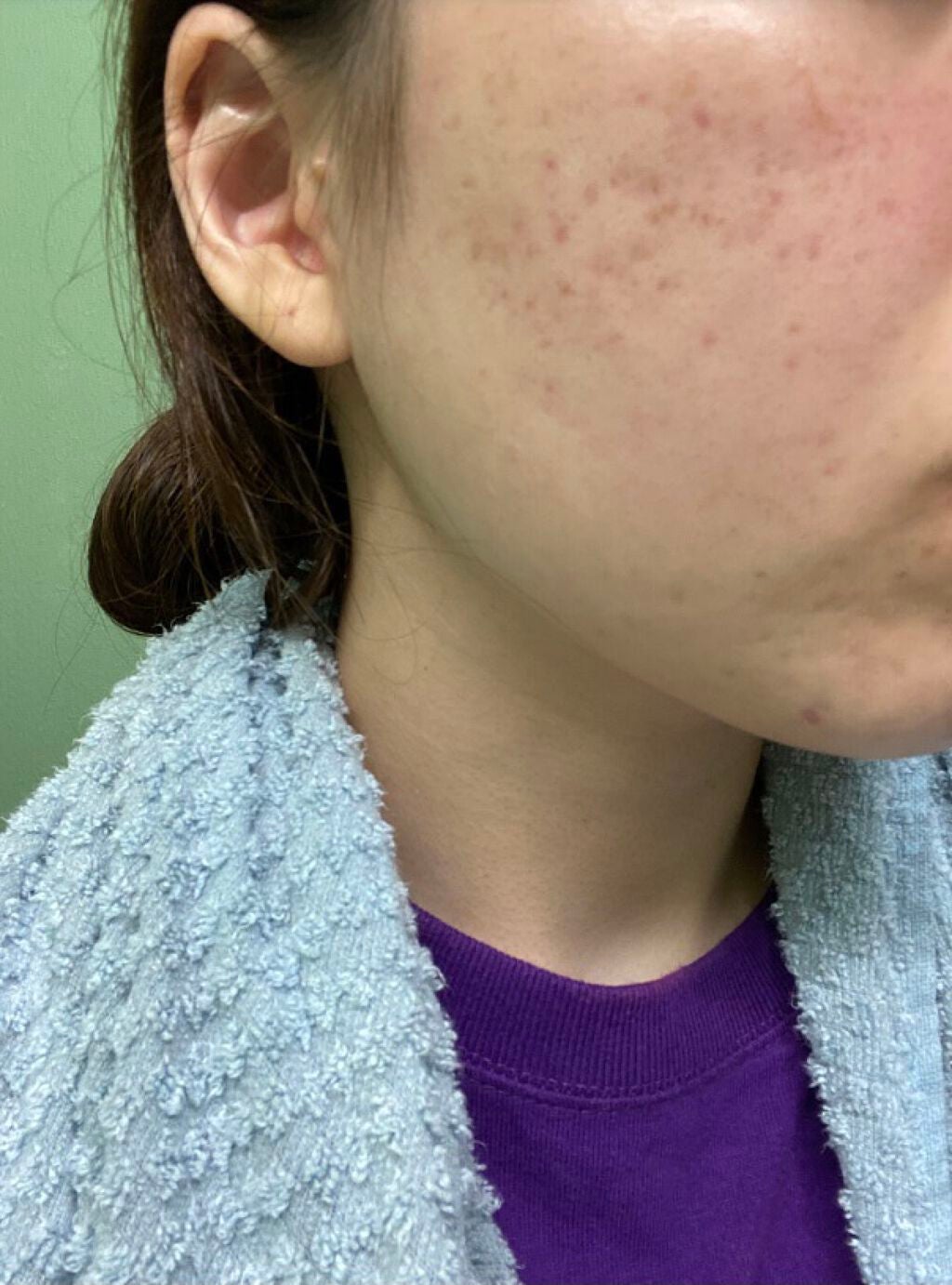 メディカルクリームG(薬用クリームG)/メンターム/ハンドクリームを使ったクチコミ(1枚目)