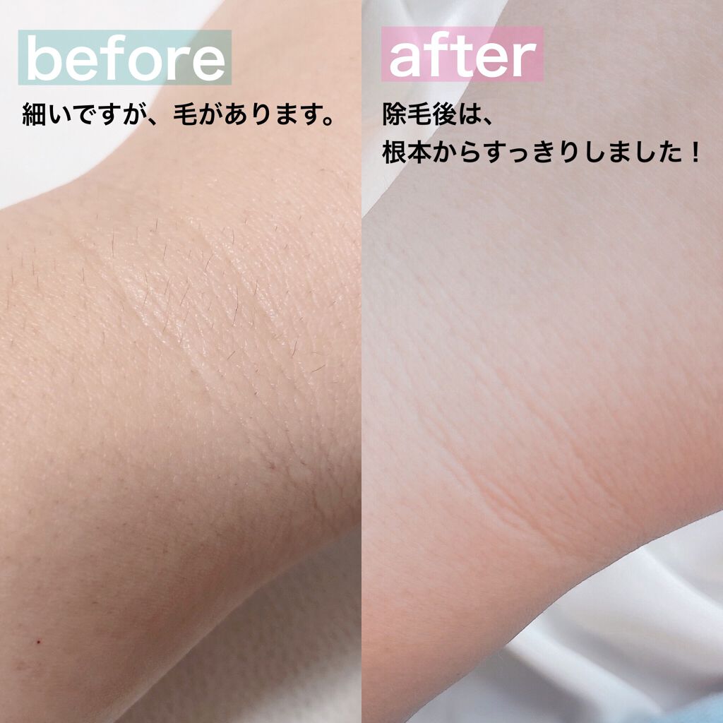 Sing薬用オイルインリムーバー/Sing/その他を使ったクチコミ(4枚目)