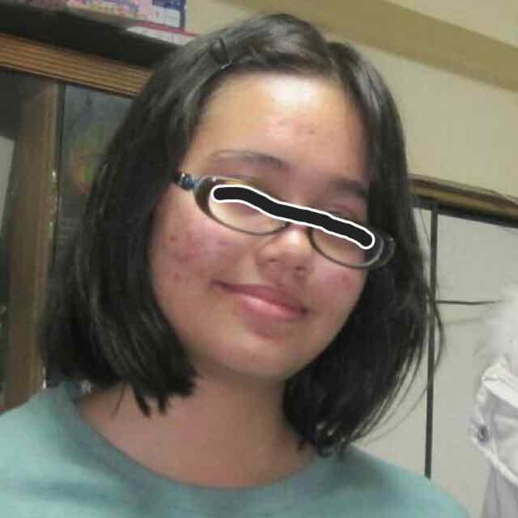 薬用3ステップセット30日サイズ/プロアクティブ/トライアルキットを使ったクチコミ（2枚目）