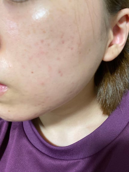 ハトムギ保湿ジェル(ナチュリエ スキンコンディショニングジェル)/ナチュリエ/美容液を使ったクチコミ(4枚目)