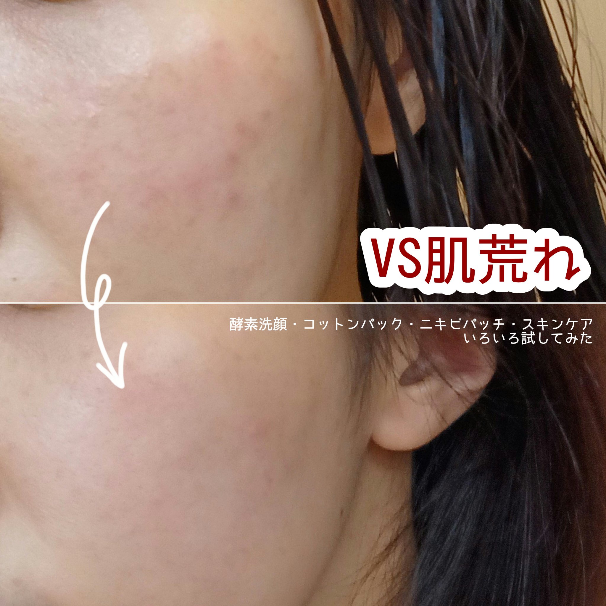 プリマモイスト ナイトクリーム/アテニア/フェイスクリームを使ったクチコミ（1枚目）