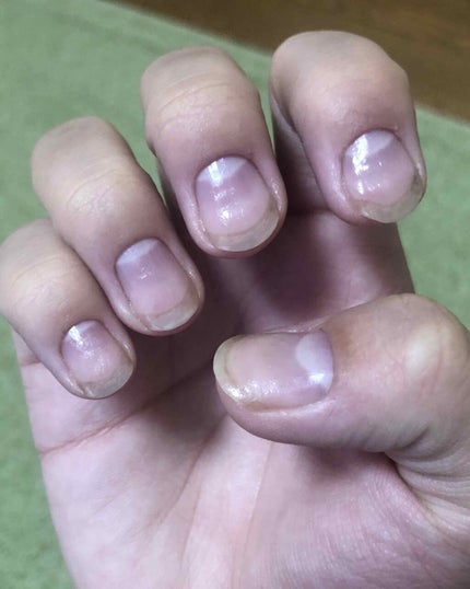 ネイルベッドオイル/アンドネイル/ネイルオイル・トリートメントを使ったクチコミ(2枚目)