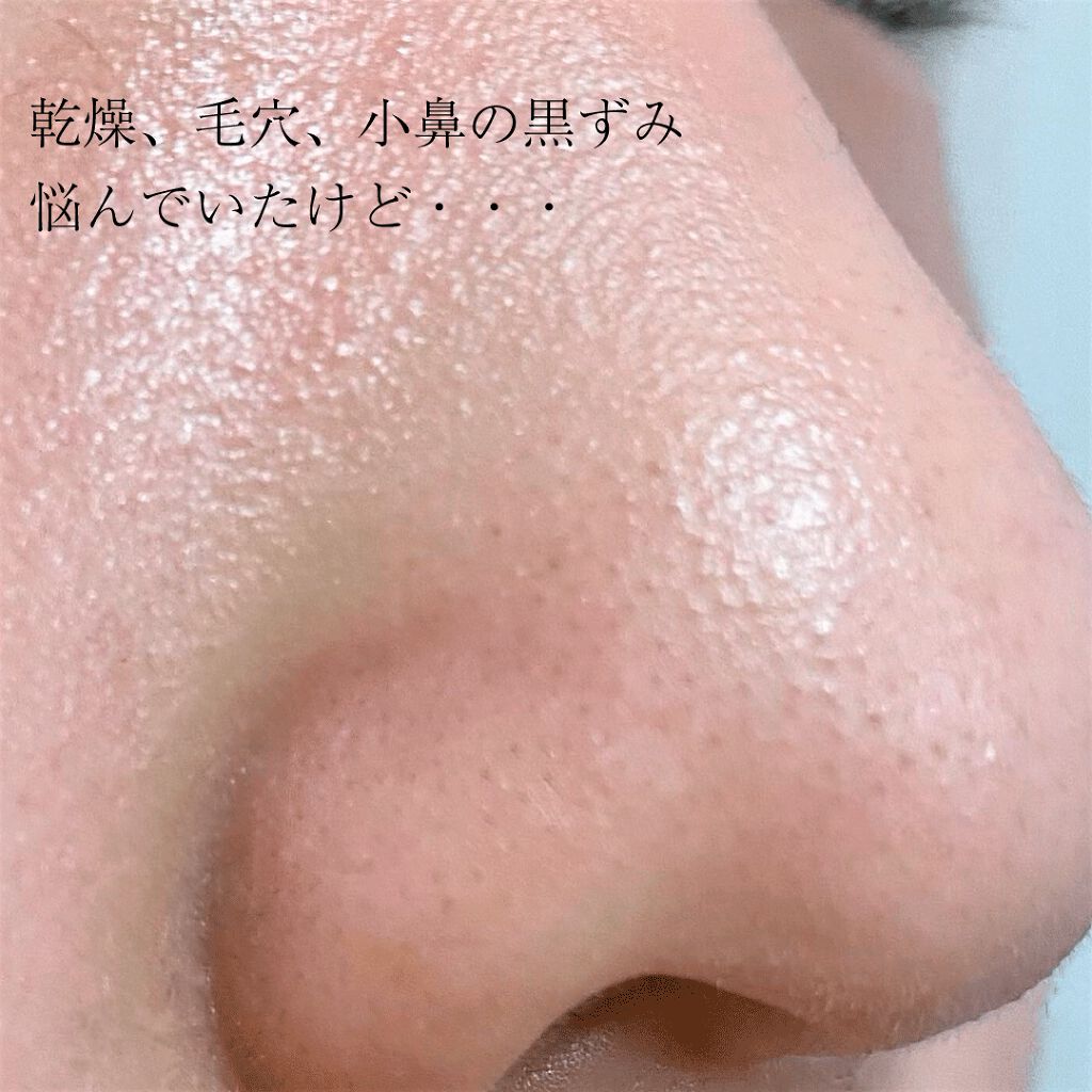 いつかの石けん/水橋保寿堂製薬/洗顔石鹸を使ったクチコミ(1枚目)