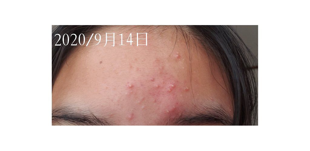 明色美顔水 薬用化粧水/美顔/化粧水を使ったクチコミ(2枚目)