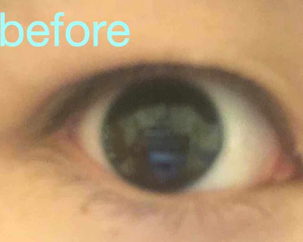 のびーるアイテープ（絆創膏タイプ、レギュラー）/DAISO/二重まぶた用アイテムを使ったクチコミ（2枚目）