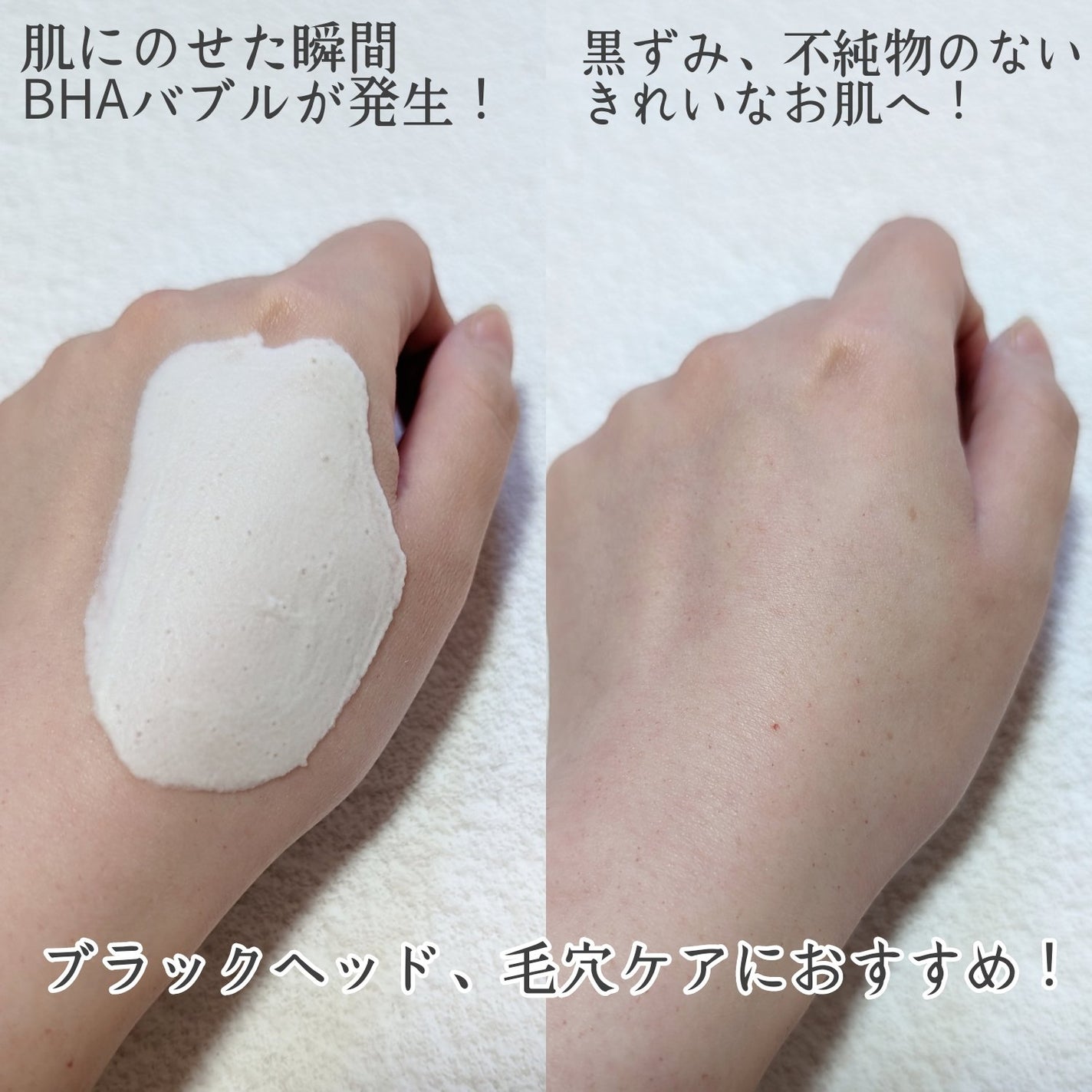 バイバイブラックヘッド グリーンティートックスバブルクレンザー/SOME BY MI/スクラブ・ゴマージュを使ったクチコミ(2枚目)