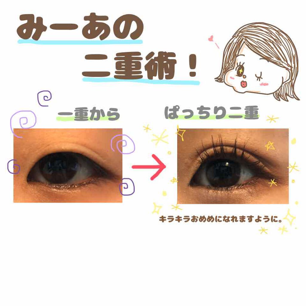 アイビューティー フィクサー WP/アストレア ヴィルゴ/二重まぶた用アイテムを使ったクチコミ(1枚目)