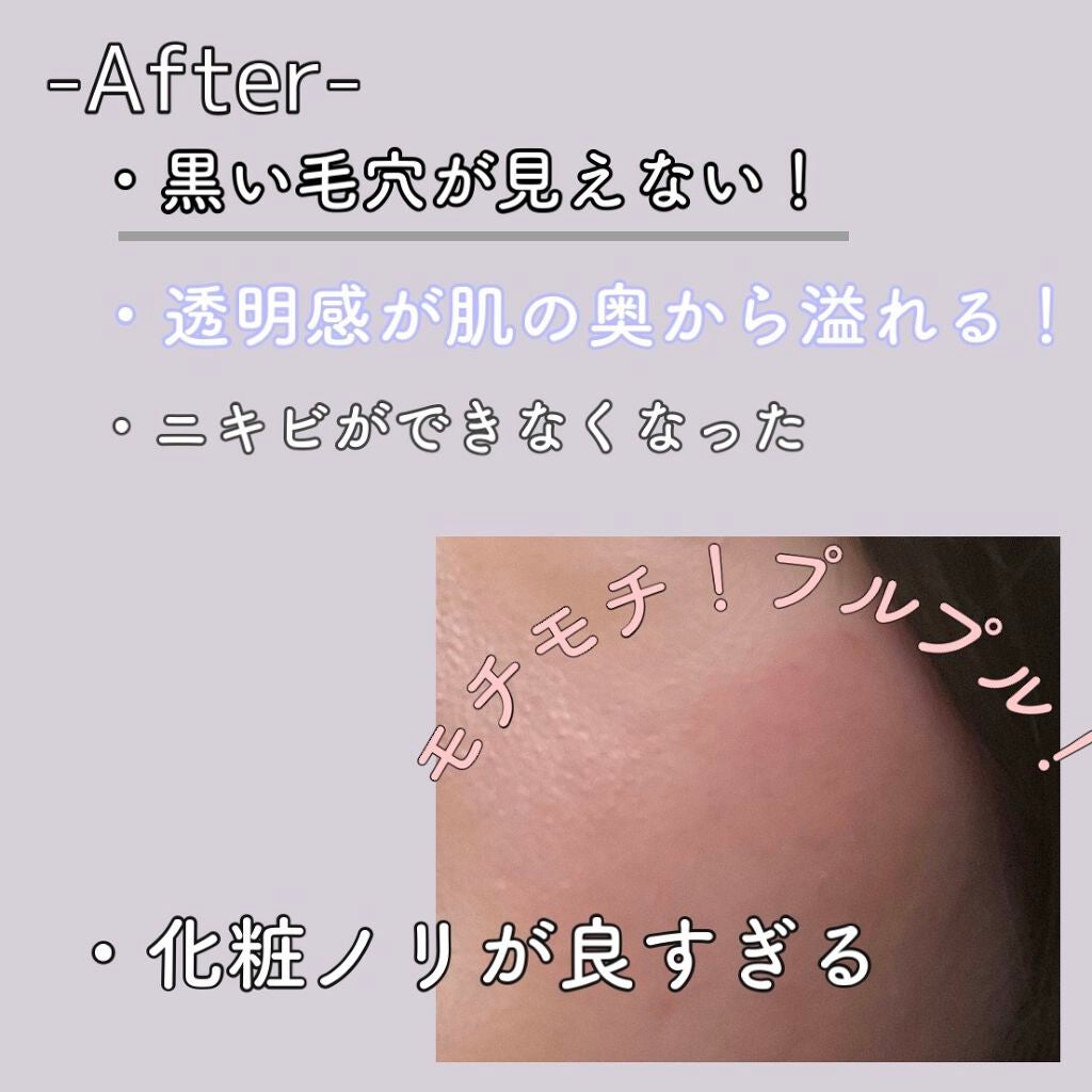 スノー エッセンス オブ ライト (医薬部外品)/Dior/美容液を使ったクチコミ(3枚目)