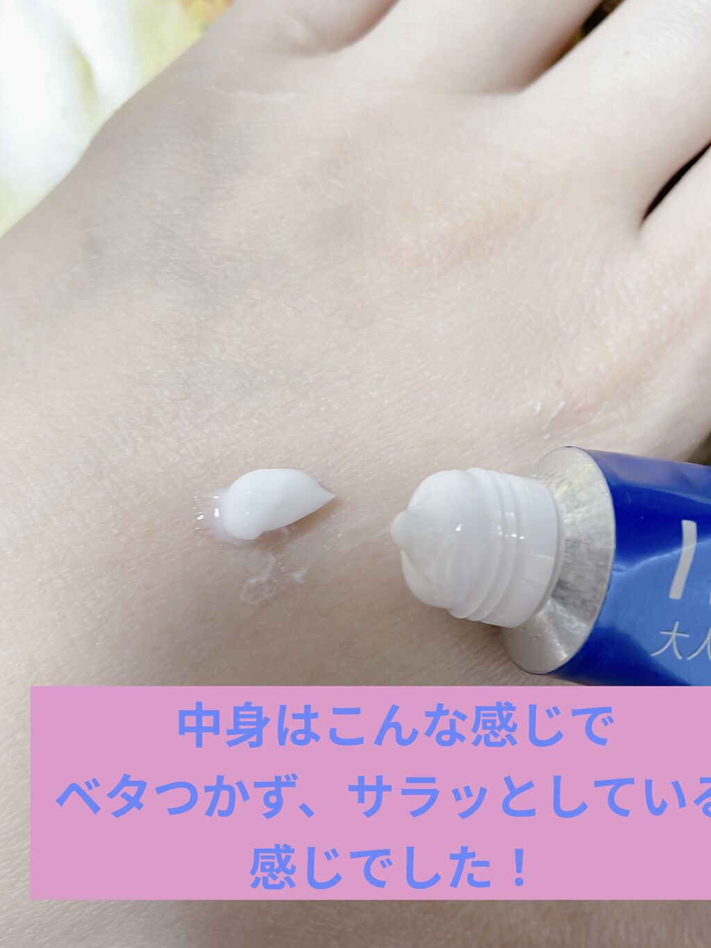 アクネキュアクリーム(医薬品)/IHADA/その他を使ったクチコミ（2枚目）