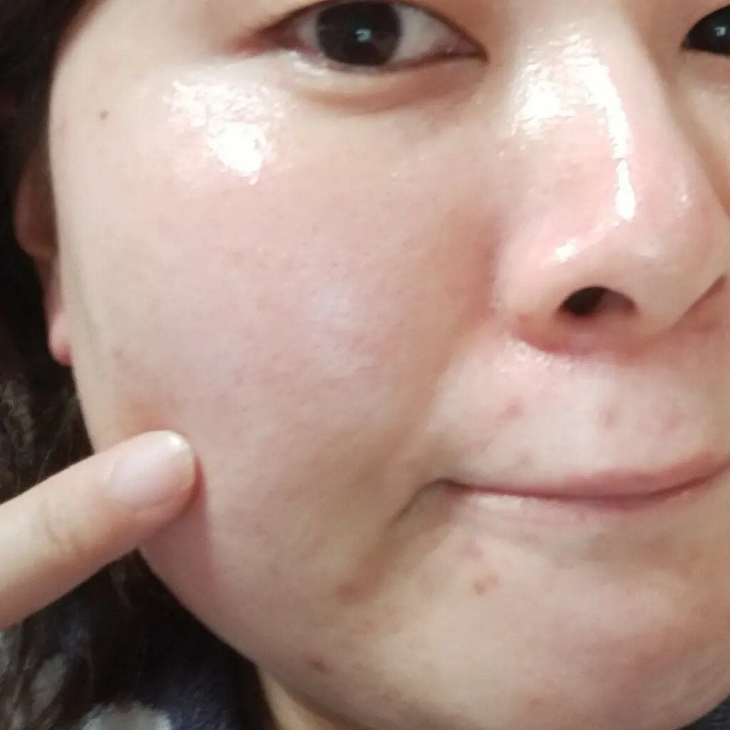 薬用コンセントレートセラム ホワイト/サナ リンクルターン/美容液を使ったクチコミ(5枚目)