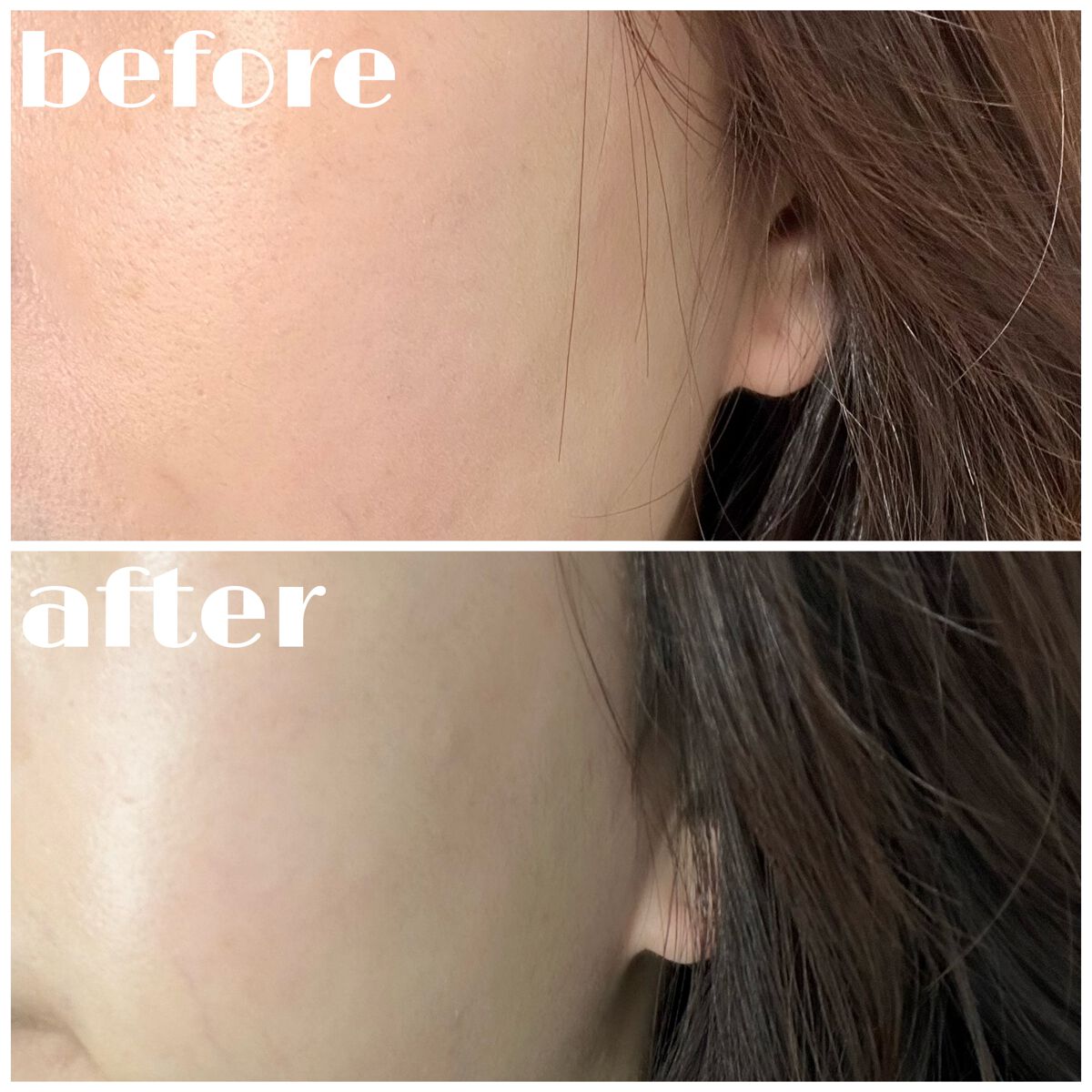 バイオ コンディショニング エッセンス/IOPE/ブースター・導入液を使ったクチコミ(3枚目)