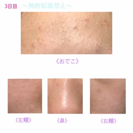 ロゼット 洗顔パスタ 荒性肌/ロゼット/洗顔フォームを使ったクチコミ(4枚目)