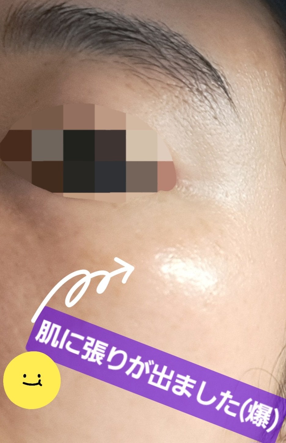 プロポリス エネルギーアンプル/CNP Laboratory/美容液を使ったクチコミ(2枚目)