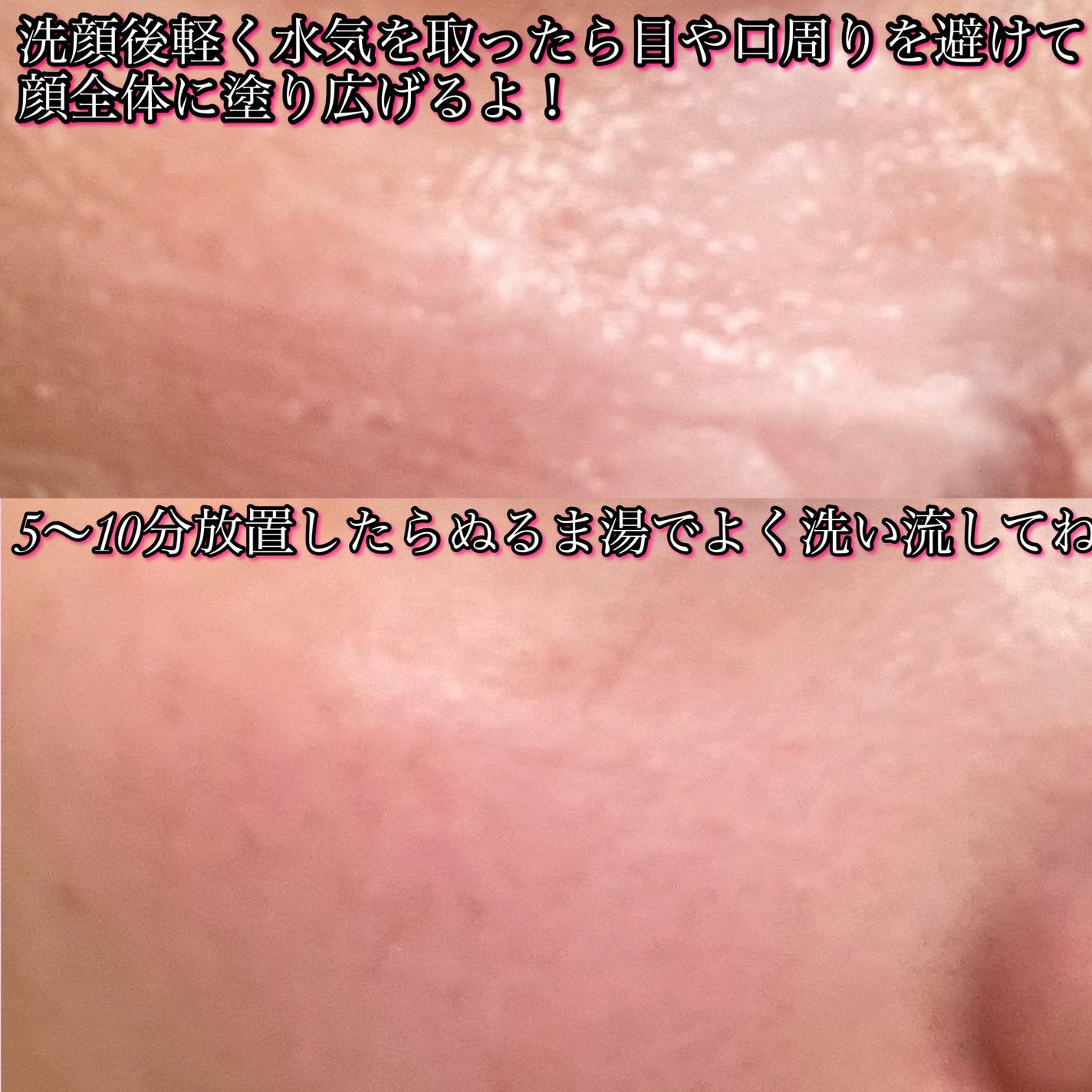 ピンクティーツリーライスシカウォッシュオフパック/APLIN/洗い流すパック・マスクを使ったクチコミ(3枚目)