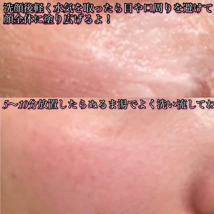 ピンクティーツリーライスシカウォッシュオフパック/APLIN/洗い流すパック・マスクを使ったクチコミ(3枚目)