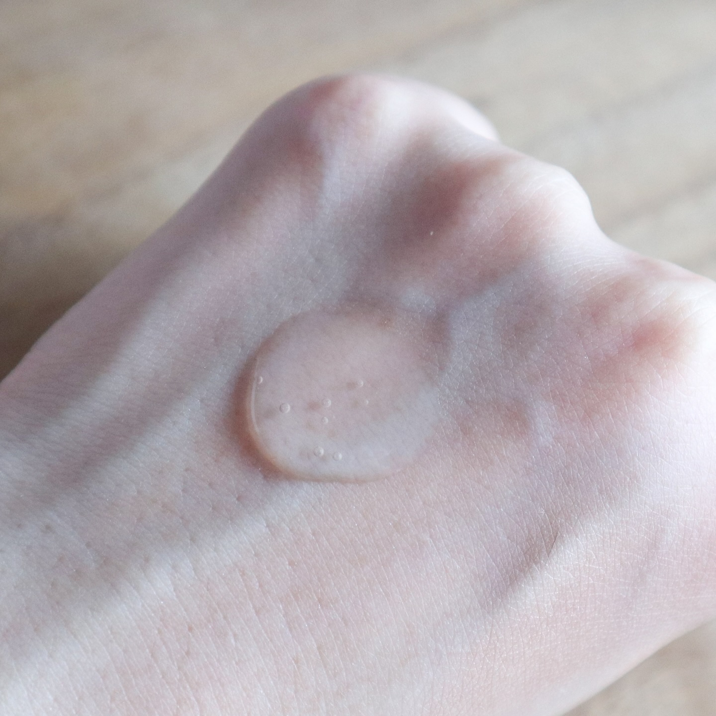 ノスカナイン トラブル セラム/FATION/美容液を使ったクチコミ（3枚目）