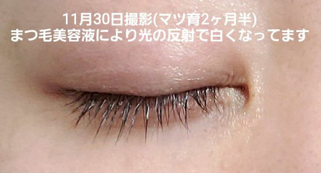 エグータム/アルマダスタイル/まつげ美容液を使ったクチコミ（3枚目）