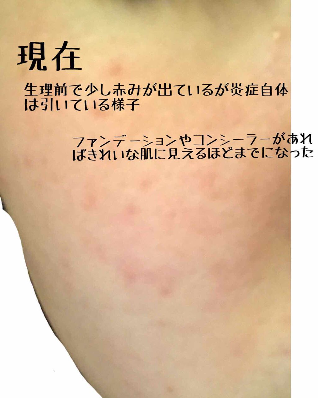 明色美顔水 薬用化粧水/美顔/化粧水を使ったクチコミ（3枚目）