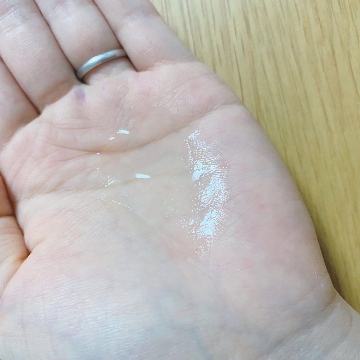 薬用 RJ地肌ケア エッセンス /アピセラピーコスメティクス/頭皮ローションを使ったクチコミ(3枚目)