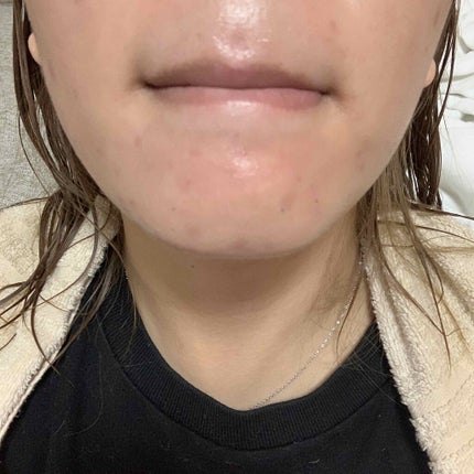 薬用 しみ 集中対策 美容液/メラノCC/美容液を使ったクチコミ(4枚目)