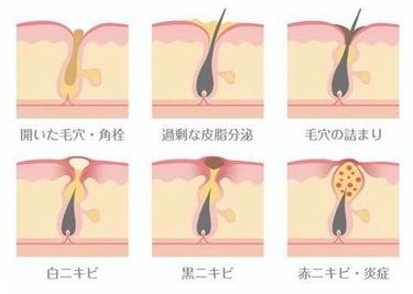 エスカメル（医薬品）/佐藤製薬/その他の画像