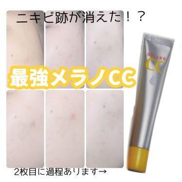 薬用しみ対策 美白化粧水/メラノCC/化粧水を使ったクチコミ（1枚目）